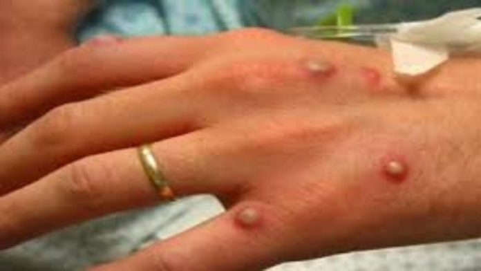 download 39 1200x675